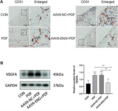 Endoglin aggravates peritoneal fibrosis by regulating the activation of TGF-β/ALK/Smads signaling